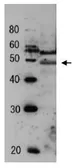 Anti-Tfg2 (S. cerevisiae) antibody used in Western Blot (WB). GTX64184