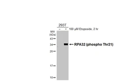 Anti-RPA32 (phospho Thr21) antibody [HL3693] used in Western Blot (WB). GTX641865