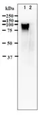 Anti-Varicella Zoster virus gE antibody [#9] used in Western Blot (WB). GTX64187