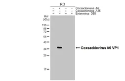 Anti-Coxsackievirus A6 VP1 antibody [HL3698] used in Western Blot (WB). GTX641870