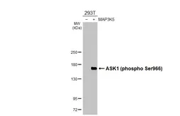 Anti-ASK1 (phospho Ser966) antibody [HL3701] used in Western Blot (WB). GTX641873