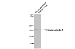 Anti-Thrombospondin 1 antibody [HL3704] used in Western Blot (WB). GTX641876