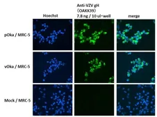Anti-Varicella Zoster virus gH antibody [OAKK39] used in Immunocytochemistry/ Immunofluorescence (ICC/IF). GTX64188