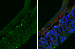 Anti-CXCR5 antibody [HL3708] used in IHC (Frozen sections) (IHC-Fr). GTX641880