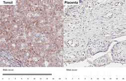 Anti-CXCR5 antibody [HL3708] used in IHC (Paraffin sections) (IHC-P). GTX641880