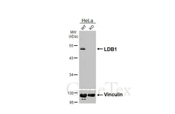 Anti-LDB1 antibody [HL3711] used in Western Blot (WB). GTX641901