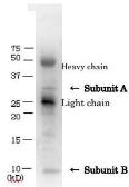 Anti-Verotoxin / Shiga toxin (SLT-1 + SLT-2) antibody used in Immunoprecipitation (IP). GTX64191