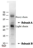 Anti-Verotoxin / Shiga toxin (SLT-1 + SLT-2) antibody used in Immunoprecipitation (IP). GTX64191