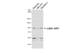 Anti-LSD2 / AOF1 antibody [HL3729] used in Western Blot (WB). GTX641919