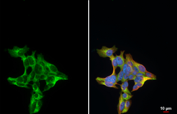 Anti-Procalcitonin antibody [HL3769] used in Immunocytochemistry/ Immunofluorescence (ICC/IF). GTX641968