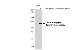 Anti-Adenovirus hexon antibody [HL3779] used in Western Blot (WB). GTX641978