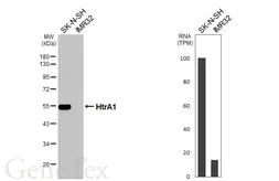 Anti-HtrA1 antibody [GT90] used in Western Blot (WB). GTX641981