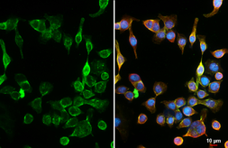Anti-GPR30 antibody [HL3783] used in Immunocytochemistry/ Immunofluorescence (ICC/IF). GTX642002