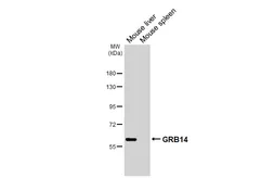 Anti-GRB14 antibody [HL3786] used in Western Blot (WB). GTX642005