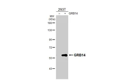 Anti-GRB14 antibody [HL3786] used in Western Blot (WB). GTX642005