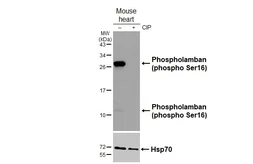 Anti-Phospholamban (phospho Ser16) antibody [HL3794] used in Western Blot (WB). GTX642013