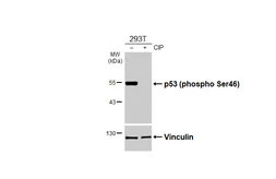 Anti-p53 (phospho Ser46) antibody [HL3795] used in Western Blot (WB). GTX642014