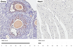 Anti-Rad51 antibody [HL3807] used in IHC (Paraffin sections) (IHC-P). GTX642031