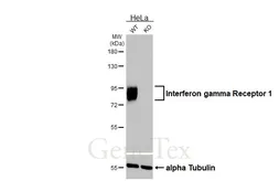 Anti-Interferon gamma Receptor 1 antibody [HL3811] used in Western Blot (WB). GTX642035