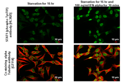 Anti-STAT1 (phospho Tyr701) antibody [HL3825] used in Immunocytochemistry/ Immunofluorescence (ICC/IF). GTX642049