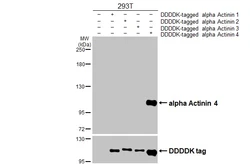 Anti-alpha Actinin 4 antibody [GT95] used in Western Blot (WB). GTX642060