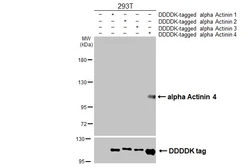 Anti-alpha Actinin 4 antibody [GT96] used in Western Blot (WB). GTX642061