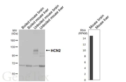 Anti-HCN2 antibody [GT98] used in Western Blot (WB). GTX642063