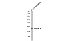 Anti-DHCR7 antibody [HL3854] used in Western Blot (WB). GTX642088
