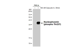 Anti-Nucleophosmin (phospho Thr237) antibody [HL3855] used in Western Blot (WB). GTX642089