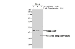 Anti-Caspase 9 antibody [HL3857] used in Western Blot (WB). GTX642095
