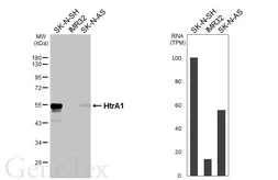 Anti-HtrA1 antibody [HL3878] used in Western Blot (WB). GTX642116