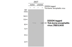 Anti-Tick-borne encephalitis virus (TBEV) NS5 antibody [HL3880] used in Western Blot (WB). GTX642118