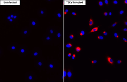 Anti-Tick-borne encephalitis virus (TBEV) NS1 antibody [HL3903] used in Immunocytochemistry/ Immunofluorescence (ICC/IF). GTX642144