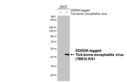 Anti-Tick-borne encephalitis virus (TBEV) NS1 antibody [HL3904] used in Western Blot (WB). GTX642145