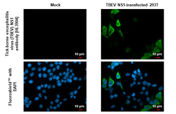 Anti-Tick-borne encephalitis virus (TBEV) NS1 antibody [HL3904] used in Immunocytochemistry/ Immunofluorescence (ICC/IF). GTX642145