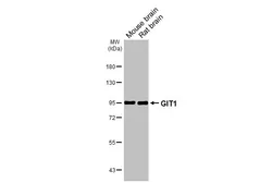 Anti-GIT1 antibody [GT104] used in Western Blot (WB). GTX642152