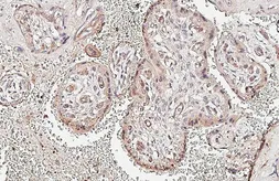 Anti-Angiopoietin 2 antibody [HL3911] used in IHC (Paraffin sections) (IHC-P). GTX642156