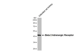 Anti-beta 2 Adrenergic Receptor antibody [HL3929] used in Western Blot (WB). GTX642174