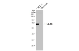 Anti-LAG3 antibody [HL3930] used in Western Blot (WB). GTX642175