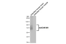 Anti-mAChR M1 antibody [HL3933] used in Western Blot (WB). GTX642178