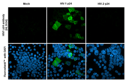 Anti-HIV1 p24 antibody [HL3934] used in Immunocytochemistry/ Immunofluorescence (ICC/IF). GTX642179