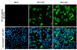 Anti-HIV p24 antibody [HL3937] used in Immunocytochemistry/ Immunofluorescence (ICC/IF). GTX642182