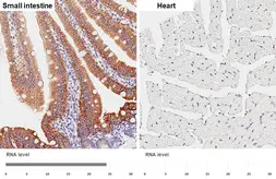Anti-HKDC1 antibody [HL3961] used in IHC (Paraffin sections) (IHC-P). GTX642211