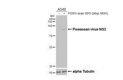 Anti-Powassan virus NS3 antibody [HL3967] used in Western Blot (WB). GTX642217