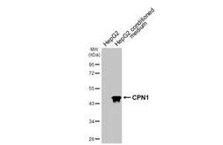 Anti-CPN1 antibody [HL3979] used in Western Blot (WB). GTX642305