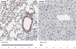 Anti-ENaC Alpha antibody [HL3980] used in IHC (Paraffin sections) (IHC-P). GTX642306