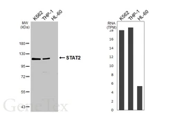 Anti-STAT2 antibody [HL3985] used in Western Blot (WB). GTX642311