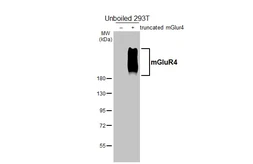 Anti-mGluR4 antibody [HL3986] used in Western Blot (WB). GTX642312