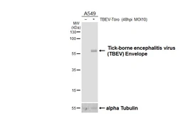 Anti-Tick-borne encephalitis virus (TBEV) Envelope antibody [HL4031] used in Western Blot (WB). GTX642362