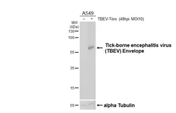 Anti-Tick-borne encephalitis virus (TBEV) Envelope antibody [HL4034] used in Western Blot (WB). GTX642365